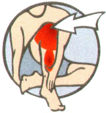 Elbow